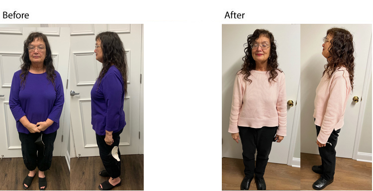 non-surgical weight loss success nj