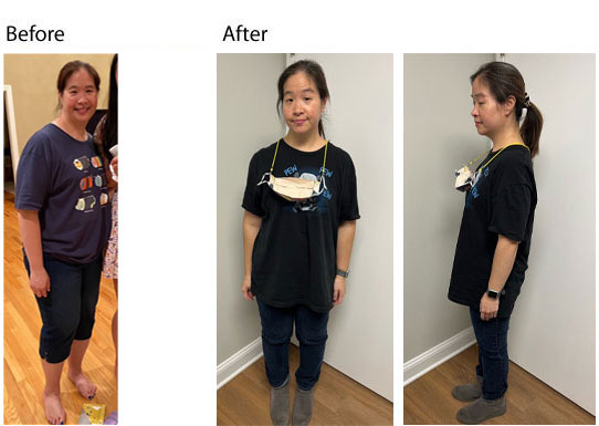 patient lost 33lbs weight loss