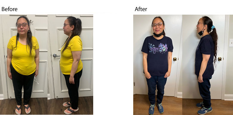Patient lost 41lbs w diet & exercise