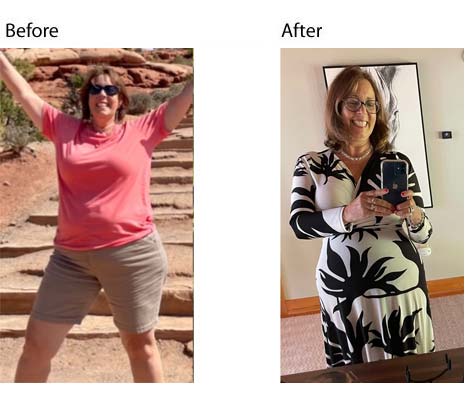 40lbs weight loss success nj doctor supervised