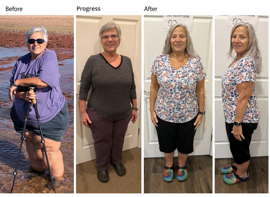 over 100lbs lost by NJ patient