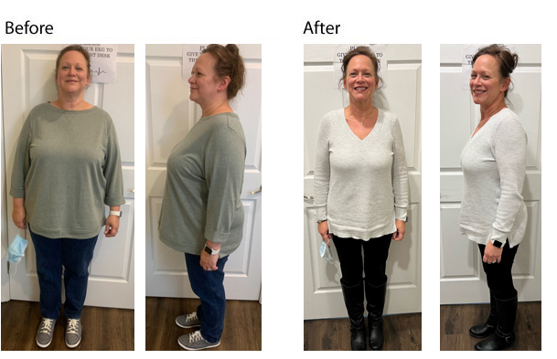 before & after nj client lost 60lbs