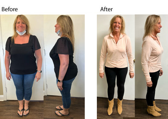 weight loss success in NJ - Dr Dave