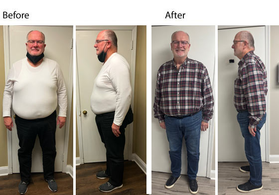 lose 100lbs - nj