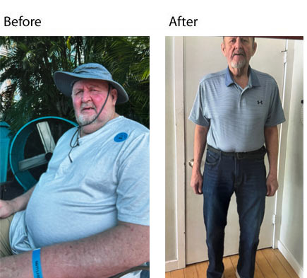 nj weight loss specialist - client loses 100lbs - 2026