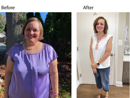 100lbs lost with Dr. Bijal Davis supervision - nj weight loss